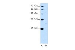 Tef Rabbit anti-Human, Polyclonal, Novus Biologicals 0.1ml; Unconjugated:Antibodies,